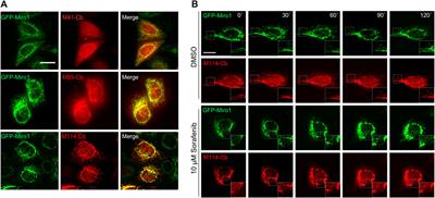 A Nanobody-Based Toolset to Monitor and Modify the Mitochondrial GTPase Miro1